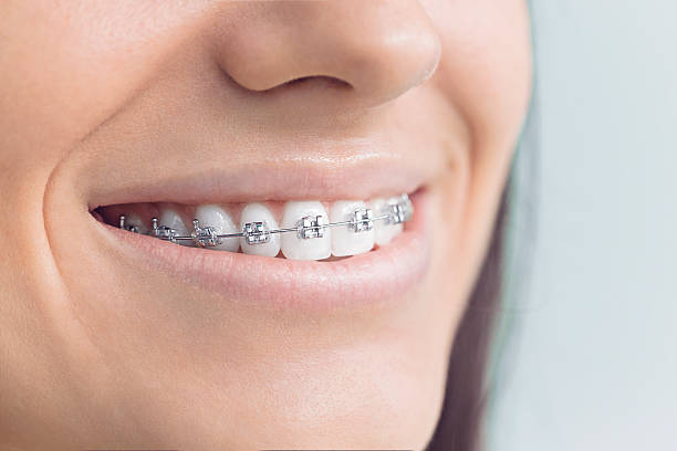 Best Wisdom Tooth Removal  in Carney, MD